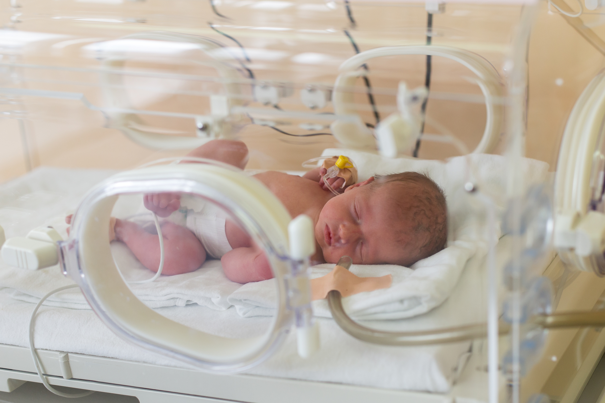 Cómo el nacimiento pretérmino puede afectar las redes neuronales