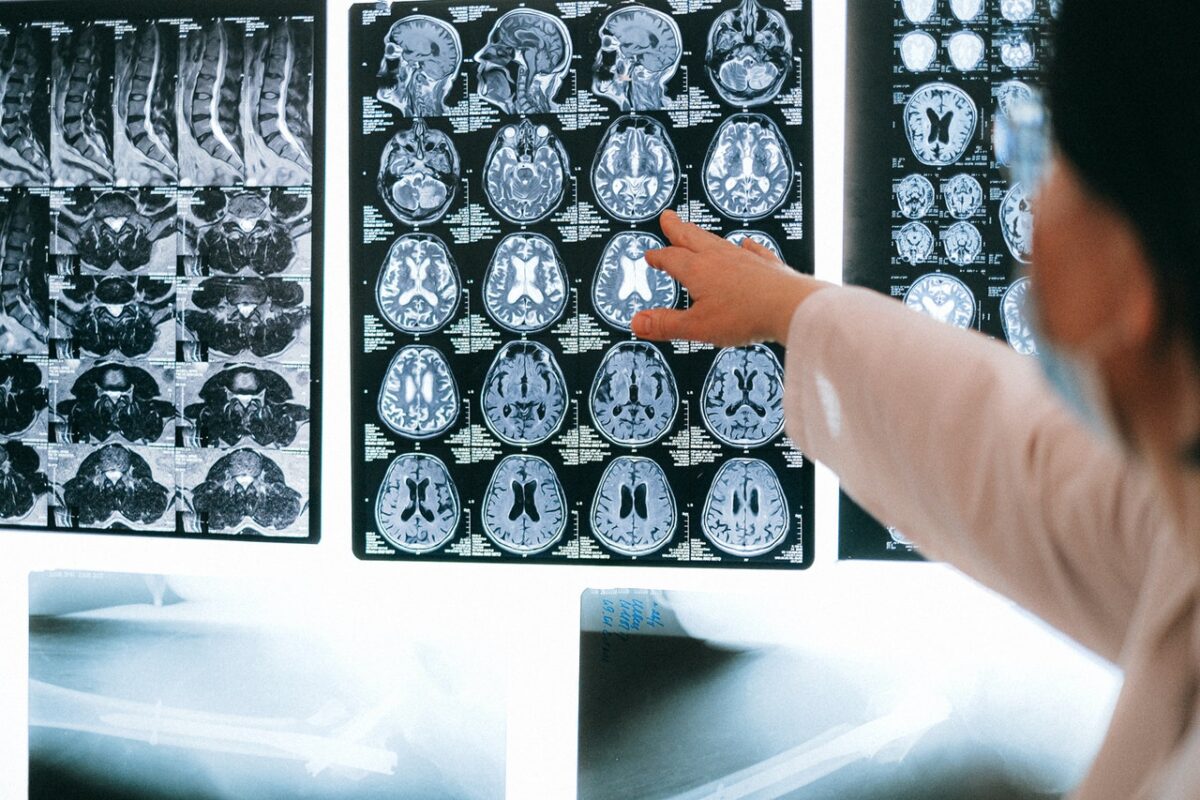 el efecto placebo y cómo aprovechar su potencial psicoterapéutico