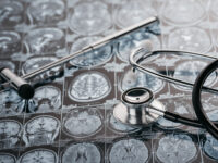 psiconeuroinmunologia