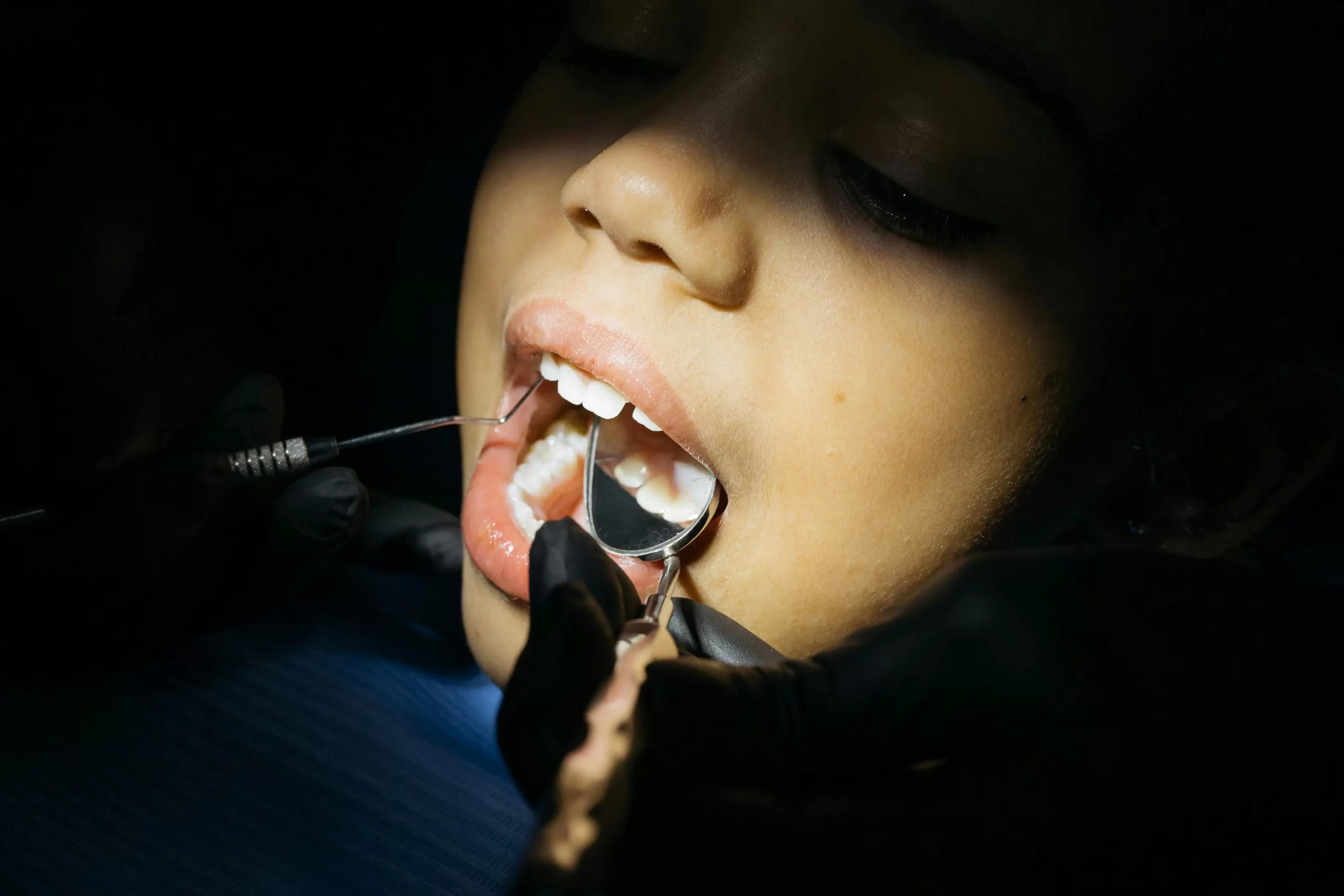 Diferencia entre un dentista general y un dentista infantil en Pachuca