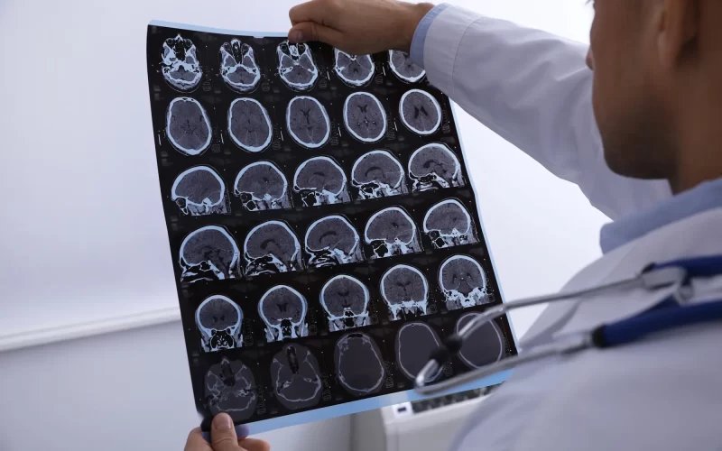 La arquitectura oculta del cerebro hiperactivo revela dos subtipos físicos distintos